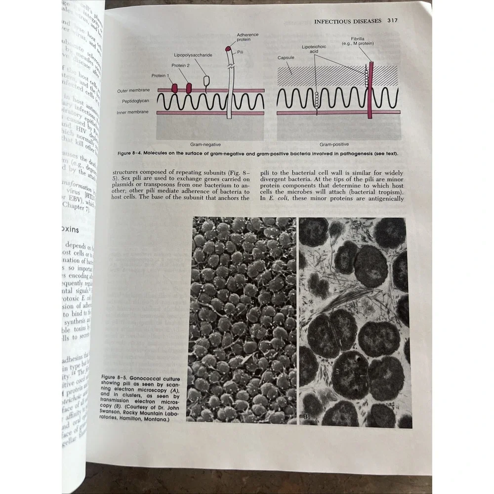 Pathologic Basis of Disease by Stanley L. Robbins 5th Edition Hardcover